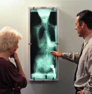 Doctor Showing X-Ray Result